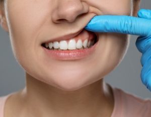 Ace Dental